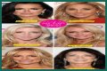 Botox, Implants & More! – Hollywood Life